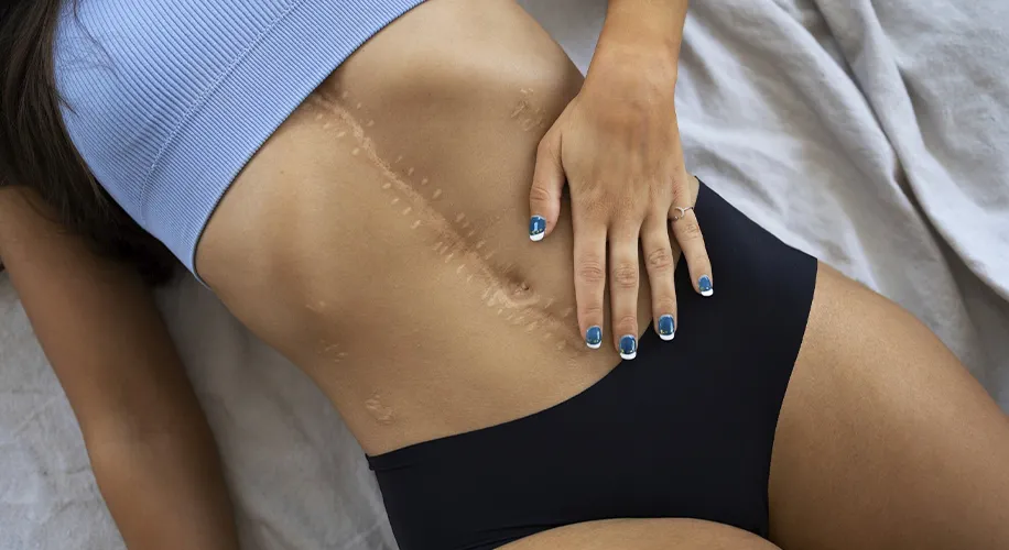 Oxigenoterapia Hiperbárica no Pré e Pós-Operatório: Prevenção de Complicações Cirúrgicas e a Importância das Tecnologias Avançadas para Resultados Superiores